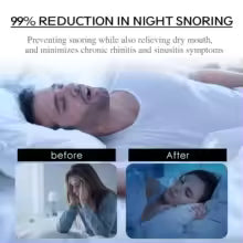 HushStrip Silent Nights Stop Snoring Set